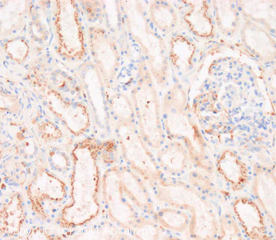 Immunohistochemistry (Formalin/PFA-fixed paraffin-embedded sections) - Anti-Vitamin D Binding protein antibody (AB65636)