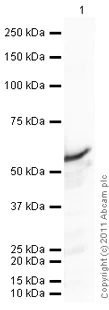 Western blot - Anti-Vitamin D Binding protein antibody (AB65636)