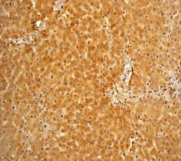 Immunohistochemistry (Formalin/PFA-fixed paraffin-embedded sections) - Anti-Vitamin D Binding protein antibody [EP2923Y] (AB81307)