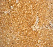 Immunohistochemistry (Formalin/PFA-fixed paraffin-embedded sections) - Anti-Vitamin D Binding protein antibody [EP2923Y] (AB81307)