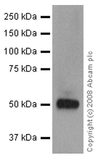 Western blot - Anti-Vitamin D Binding protein antibody [EP2923Y] (AB81307)