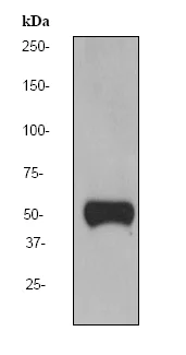 Western blot - Anti-Vitamin D Binding protein antibody [EPR2922Y] (AB76537)