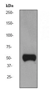 Western blot - Anti-Vitamin D Binding protein antibody [EPR2922Y] - BSA and Azide free (AB247487)
