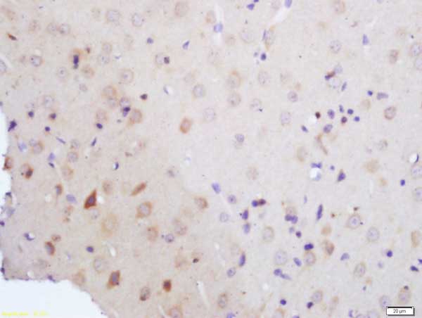 Immunohistochemistry (Formalin/PFA-fixed paraffin-embedded sections) - Anti-Vitamin D Receptor antibody (AB216514)