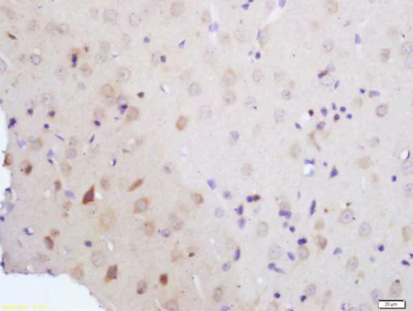 Immunohistochemistry (Formalin/PFA-fixed paraffin-embedded sections) - Anti-Vitamin D Receptor antibody (AB216514)