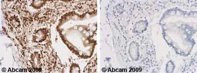 Immunohistochemistry (Formalin/PFA-fixed paraffin-embedded sections) - Anti-Vitamin D Receptor antibody (AB3508)