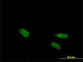 Immunocytochemistry/ Immunofluorescence - Anti-Vitamin D Receptor antibody (AB89626), expandable thumbnail