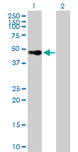 Western blot - Anti-Vitamin D Receptor antibody (AB89626), expandable thumbnail