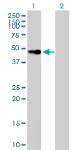 Western blot - Anti-Vitamin D Receptor antibody (AB89626)