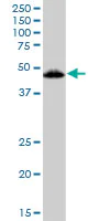 Western blot - Anti-Vitamin D Receptor antibody (AB89626)