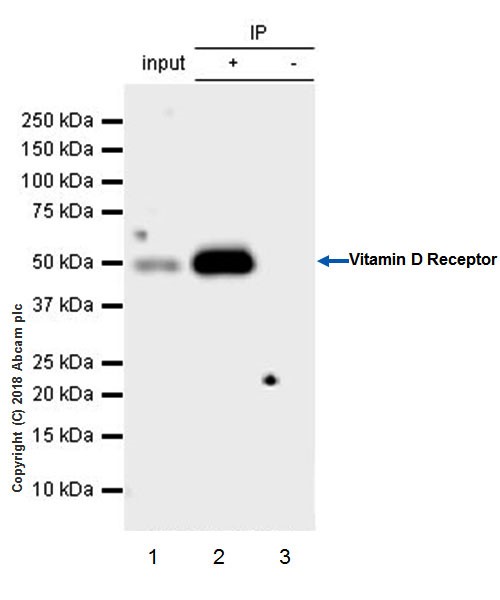 Immunoprecipitation - Anti-Vitamin D Receptor antibody [EPR4552] - BSA and Azide free (AB239958)