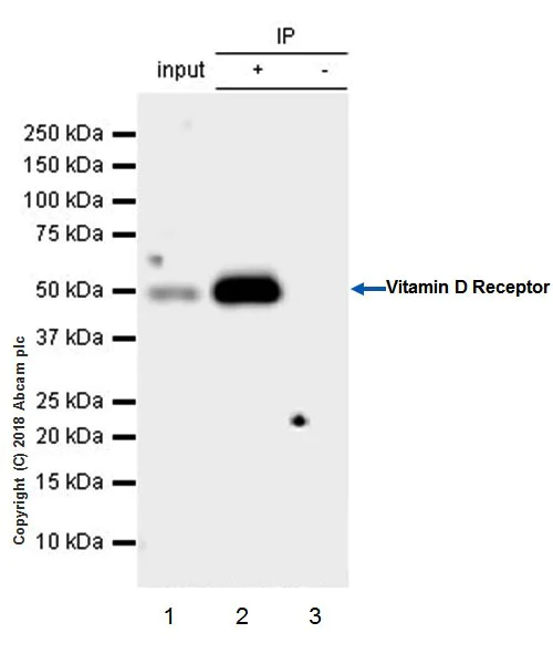 Immunoprecipitation - Anti-Vitamin D Receptor antibody [EPR4552] - BSA and Azide free (AB239958)