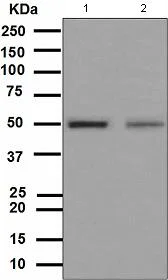 Western blot - Anti-Vitamin D Receptor antibody [EPR4552] - ChIP Grade (AB109234)