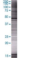 Vitamin D Receptor overexpression 293T lysate (whole cell)