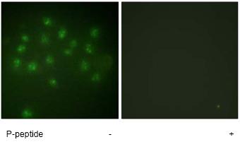 Immunocytochemistry/ Immunofluorescence - Anti-Vitamin D Receptor (phospho S208) antibody (AB63572), expandable thumbnail
