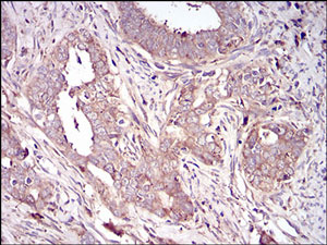 Immunohistochemistry (Formalin/PFA-fixed paraffin-embedded sections) - Anti-Vitronectin/S-Protein antibody [1G11E8] (AB201981), expandable thumbnail