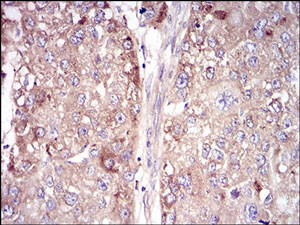 Immunohistochemistry (Formalin/PFA-fixed paraffin-embedded sections) - Anti-Vitronectin/S-Protein antibody [1G11E8] (AB201981), expandable thumbnail