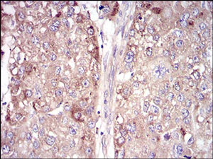 Immunohistochemistry (Formalin/PFA-fixed paraffin-embedded sections) - Anti-Vitronectin/S-Protein antibody [1G11E8] (AB201981)