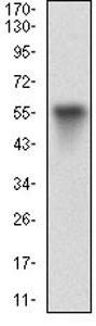 Western blot - Anti-Vitronectin/S-Protein antibody [1G11E8] (AB201981), expandable thumbnail