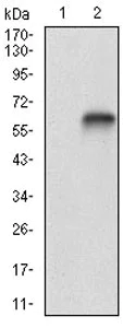 Western blot - Anti-Vitronectin/S-Protein antibody [1G11E8] (AB201981)