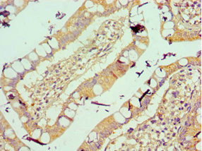 Immunohistochemistry (Formalin/PFA-fixed paraffin-embedded sections) - Anti-Vitronectin/S-Protein antibody (AB235987), expandable thumbnail