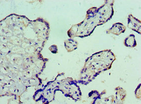 Immunohistochemistry (Formalin/PFA-fixed paraffin-embedded sections) - Anti-Vitronectin/S-Protein antibody (AB235987), expandable thumbnail