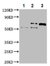 Immunoprecipitation - Anti-Vitronectin/S-Protein antibody (AB235987), expandable thumbnail