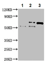 Immunoprecipitation - Anti-Vitronectin/S-Protein antibody (AB235987)