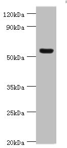 Western blot - Anti-Vitronectin/S-Protein antibody (AB235987), expandable thumbnail