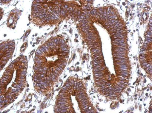 Immunohistochemistry (Formalin/PFA-fixed paraffin-embedded sections) - Anti-Vitronectin/S-Protein antibody (AB272865)