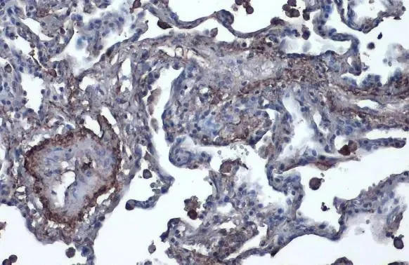 Immunohistochemistry (Formalin/PFA-fixed paraffin-embedded sections) - Anti-Vitronectin/S-Protein antibody (AB272865)