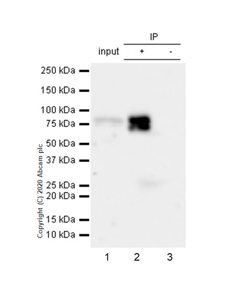 Immunoprecipitation - Anti-Vitronectin/S-Protein antibody [EP781Y] (AB46808), expandable thumbnail
