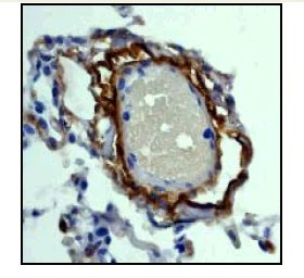Immunohistochemistry (Formalin/PFA-fixed paraffin-embedded sections) - Anti-Vitronectin/S-Protein antibody [EP781Y] - BSA and Azide free (AB247306)