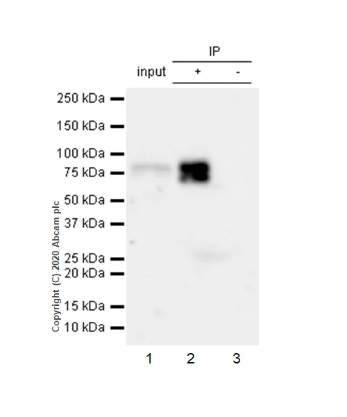 Immunoprecipitation - Anti-Vitronectin/S-Protein antibody [EP781Y] - BSA and Azide free (AB247306)
