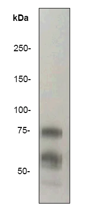Western blot - Anti-Vitronectin/S-Protein antibody [EP781Y] - BSA and Azide free (AB247306)