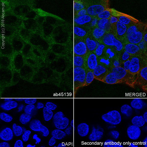Immunocytochemistry/ Immunofluorescence - Anti-Vitronectin/S-Protein antibody [EP873Y] (AB45139), expandable thumbnail