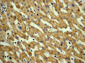 Immunohistochemistry (Formalin/PFA-fixed paraffin-embedded sections) - Anti-Vitronectin/S-Protein antibody [EP873Y] (AB45139), expandable thumbnail