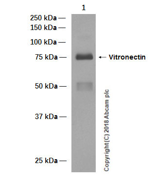 Western blot - Anti-Vitronectin/S-Protein antibody [EP873Y] (AB45139), expandable thumbnail