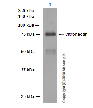 Western blot - Anti-Vitronectin/S-Protein antibody [EP873Y] (AB45139)