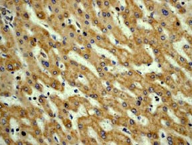 Immunohistochemistry (Formalin/PFA-fixed paraffin-embedded sections) - Anti-Vitronectin/S-Protein antibody [EP873Y] - Low endotoxin, Azide free (AB228480), expandable thumbnail
