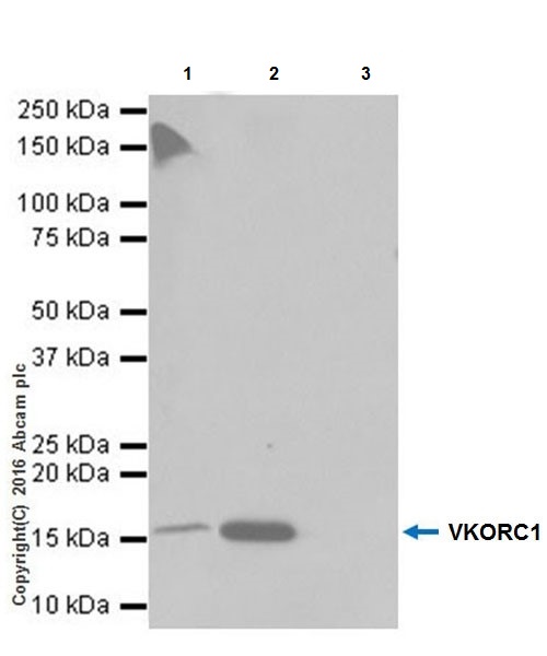 Immunoprecipitation - Anti-VKORC1 antibody [EPR20245] - BSA and Azide free (ab251460), expandable thumbnail