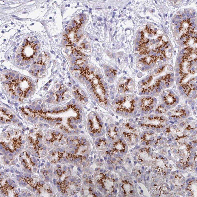 Immunohistochemistry (Formalin/PFA-fixed paraffin-embedded sections) - Anti-VKORC1L1 antibody (AB272657)