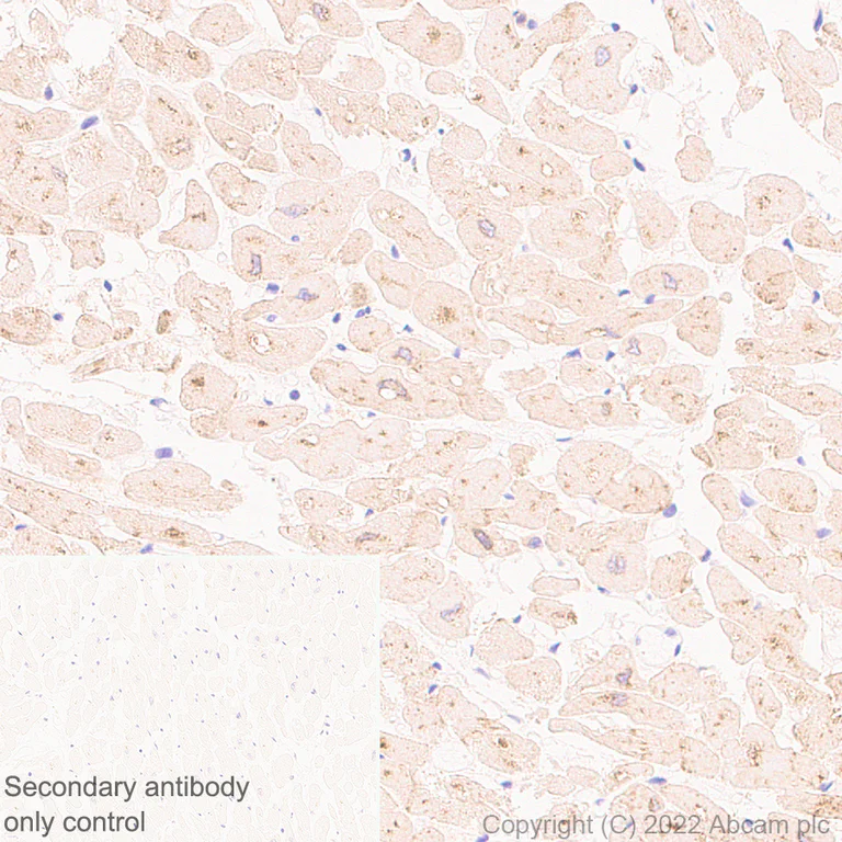 Immunohistochemistry - Anti-VLDL Receptor/VLDL-R antibody [EPR26178-72] (AB302917)