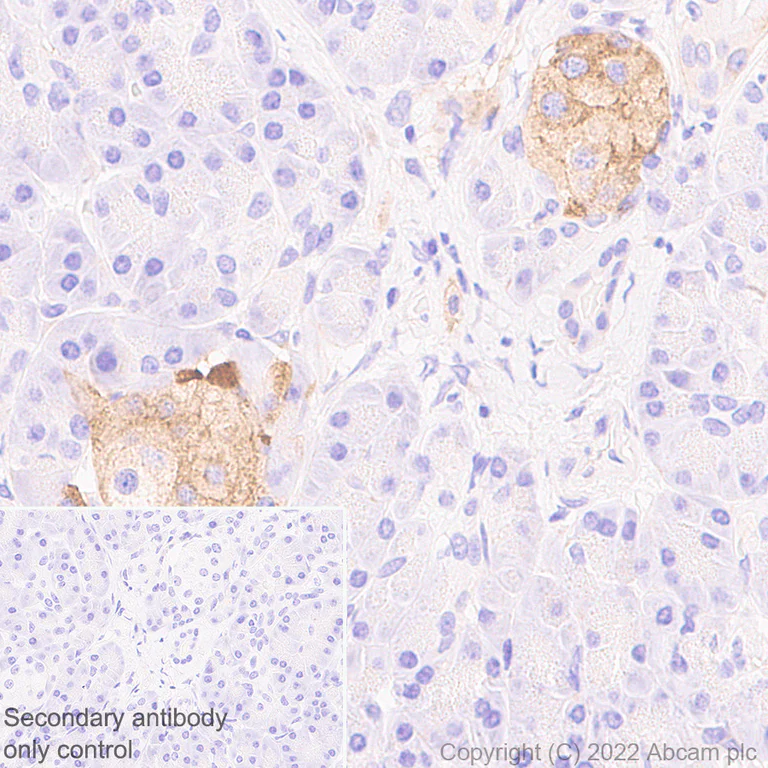 Immunohistochemistry - Anti-VLDL Receptor/VLDL-R antibody [EPR26178-72] (AB302917)