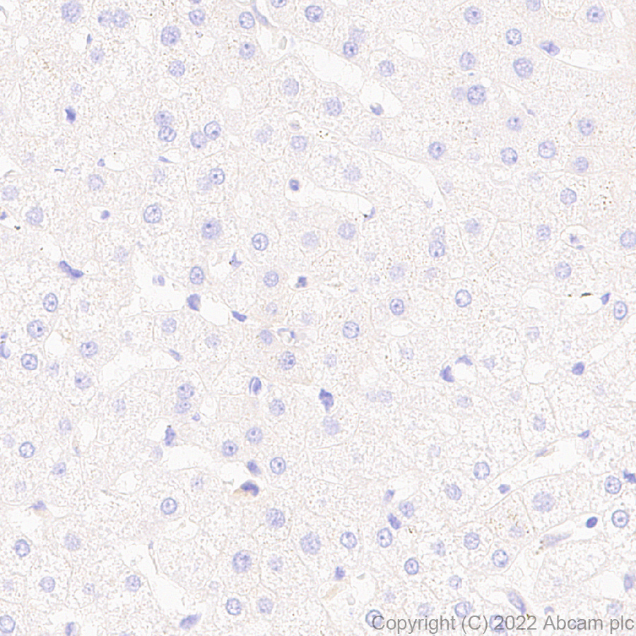 Immunohistochemistry - Anti-VLDL Receptor/VLDL-R antibody [EPR26178-72] (AB302917)