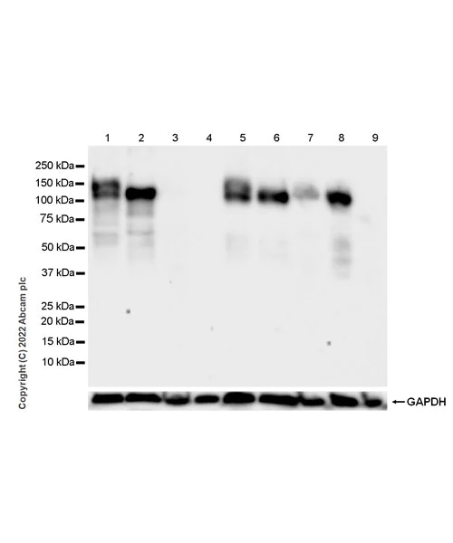 Western blot - Anti-VLDL Receptor/VLDL-R antibody [EPR26178-72] (AB302917)