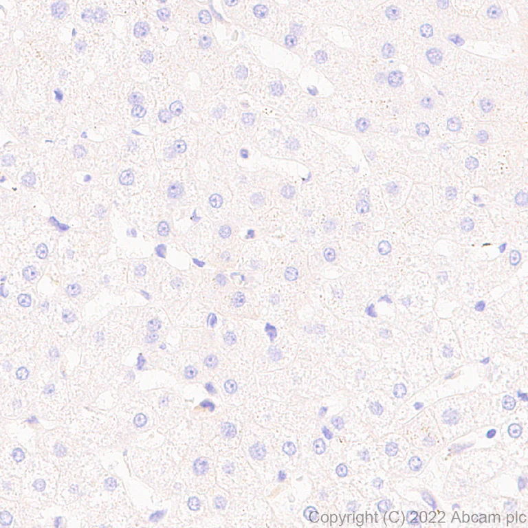Immunohistochemistry - Anti-VLDL Receptor/VLDL-R antibody [EPR26178-72] (BSA and Azide free) (AB302918)