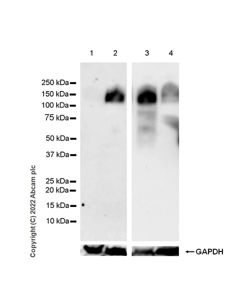 Western blot - Anti-VLDL Receptor/VLDL-R antibody [EPR26178-72] (BSA and Azide free) (AB302918)