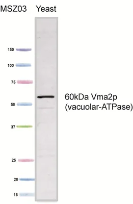 Western blot - Anti-VMA2 antibody [13D11B2] (AB113684)