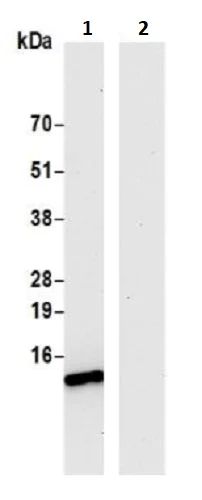 Immunoprecipitation - Anti-VMA21 antibody (AB242115)